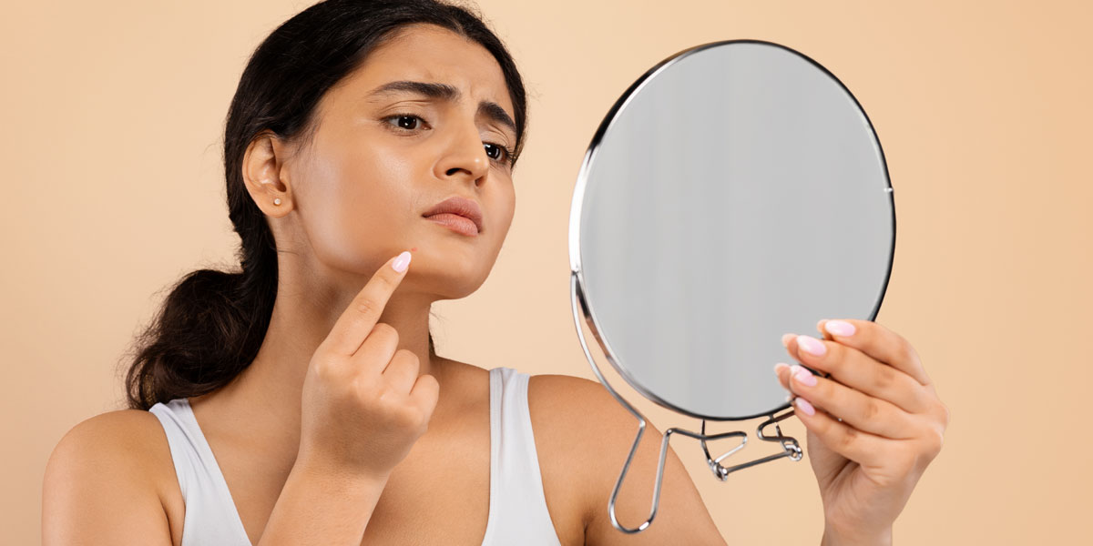 Top 10 Ways to Treat and Prevent Body Acne